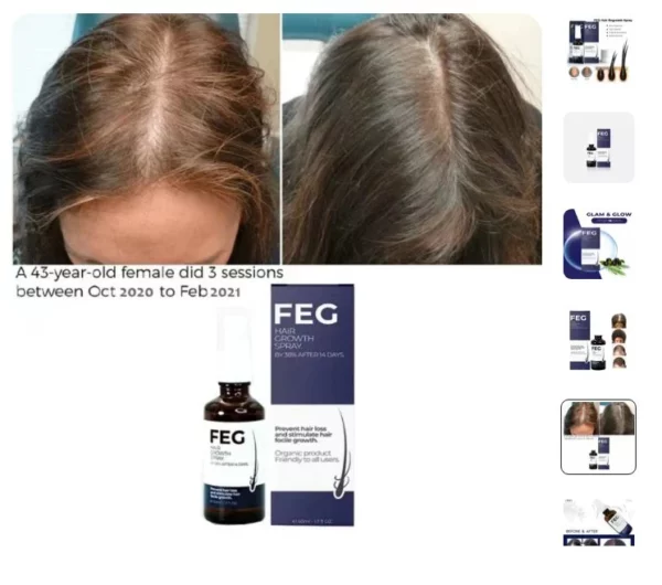 بخاخ نمو الشعر بمكونات طبيعية بالكامل FEG